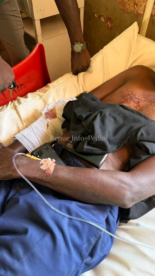 FRESH PLATEAU ATT@CK LEAVES SEVERAL INJURED IN BARKIN LADI COMMUNITY 