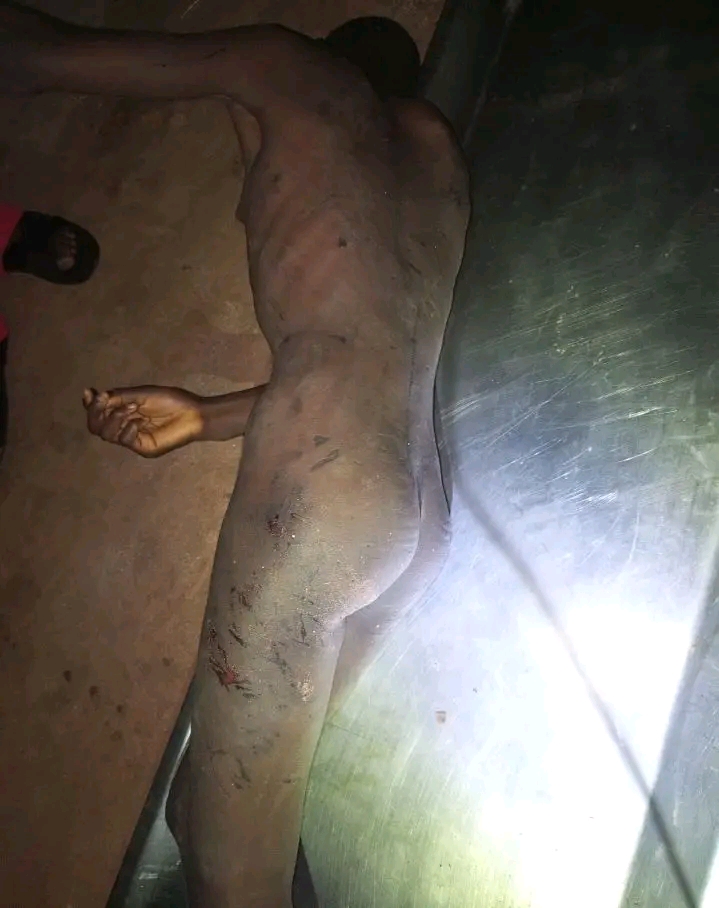 Benue Girl Allegedly Sold to Edo Resident, Brutalized Over Theft Accusation