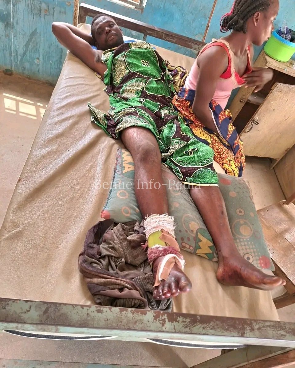 Police Confirm Calm After One Dies, Over 10 Injured in Bali Farmer-Herder Clash 